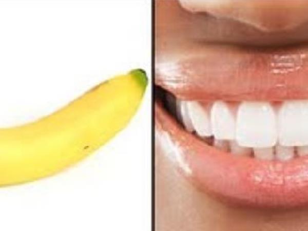 Ali podobnost res zdravi?